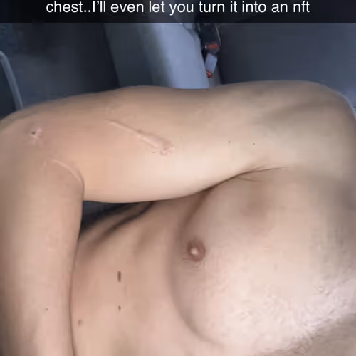 Chest of Kodeine