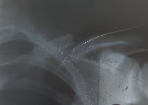 Item #42602188936332751126689195921772117794695800626097073962556397746040193679361 Media