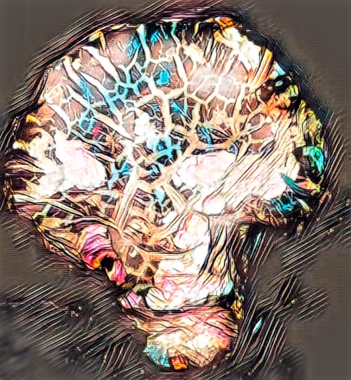 Item #80050559332347163335601971796963442430023304175303914027877321142864783081572 Media