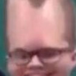  MrTLexify forehead #1