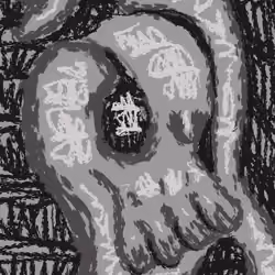Distort bone
