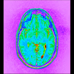 64162533542198579898252916190583583845604629893829087458582976440683854823425