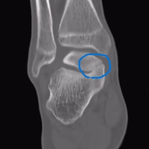 sokukonkotsuyugousyou