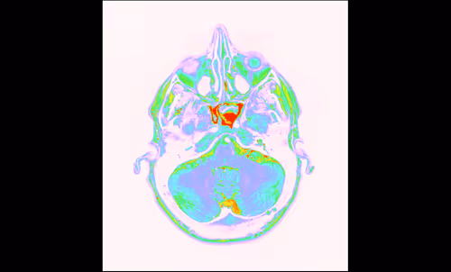 Item #64162533542198579898252916190583583845604629893829087458582975900823645585409 Media