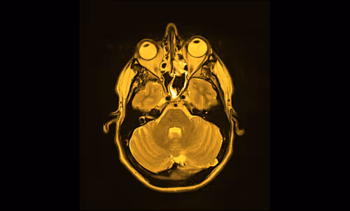 Item #64162533542198579898252916190583583845604629893829087458582976050357226962945 Media