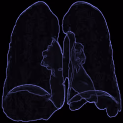 Covid19Lungs #105