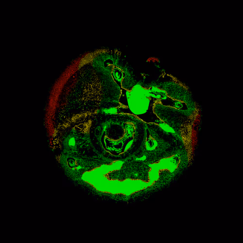 Eye #11