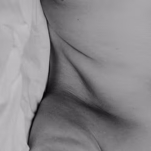 Skin Story #26