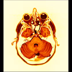 64162533542198579898252916190583583845604629893829087458582976022869436268545