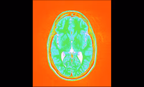 Item #64162533542198579898252916190583583845604629893829087458582976530843808301057 Media