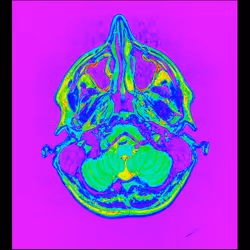 64162533542198579898252916190583583845604629893829087458582975700712529330177