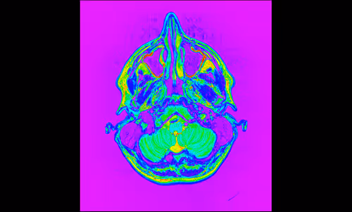 Item #64162533542198579898252916190583583845604629893829087458582975700712529330177 Media