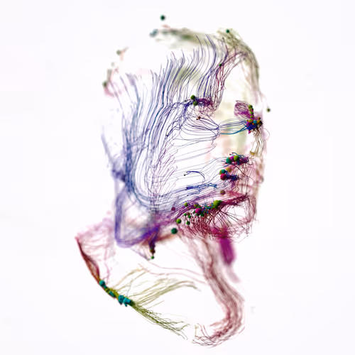 Envisaged
