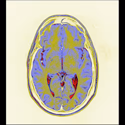 64162533542198579898252916190583583845604629893829087458582976504455529234433