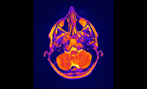 Item #64162533542198579898252916190583583845604629893829087458582975775479320018945 Media