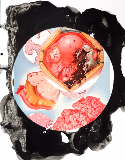 Item #35041902778173331559680500540735012093335203387204658820110218336842331193345 Media