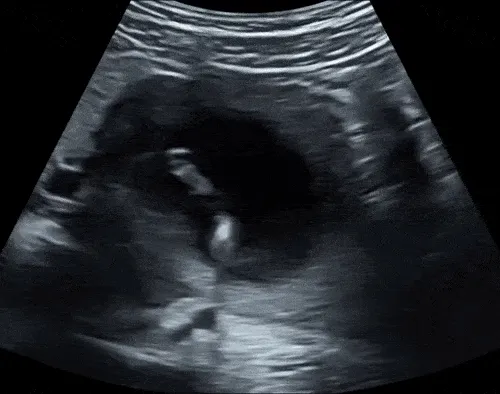 Cryptobaby