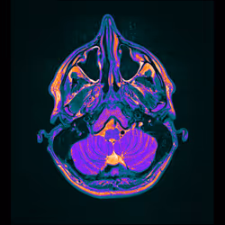 64162533542198579898252916190583583845604629893829087458582975722702761885697