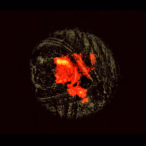 Eye #5