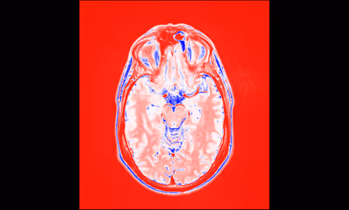 Item #64162533542198579898252916190583583845604629893829087458582976328533668790273 Media