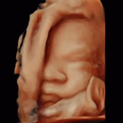 Life Starts in the Womb # 2