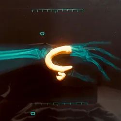 42502377884493822439484110895335049498054174976923948741203377792178972524545