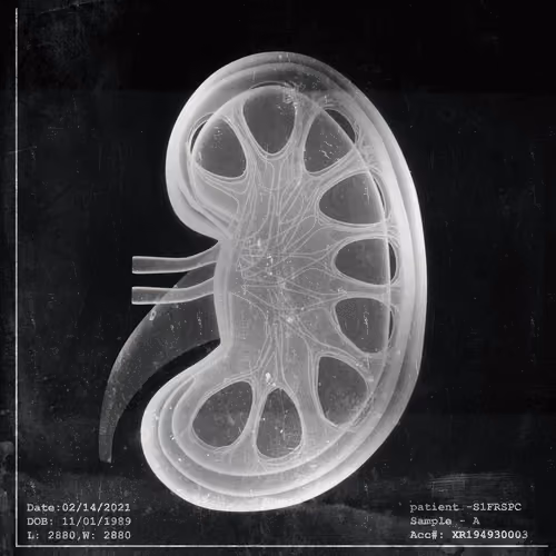 My Left Kidney