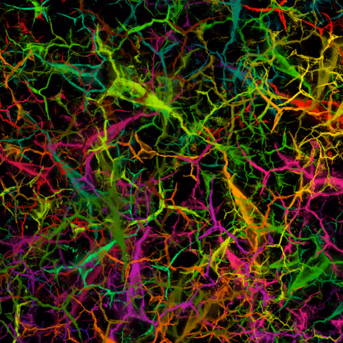 Item #50918555062582210159273167721725581522404743190091886750106034872898004451329 Media