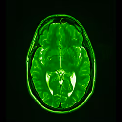 64162533542198579898252916190583583845604629893829087458582976474768715284481