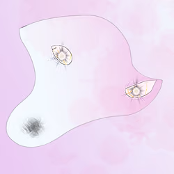 Cirrhosis