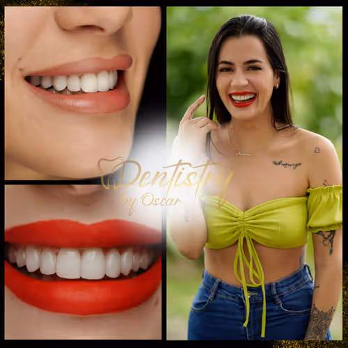 Oscar Sanchez Smile Makeover Collection