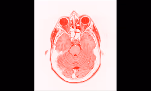 Item #64162533542198579898252916190583583845604629893829087458582976140517180440577 Media