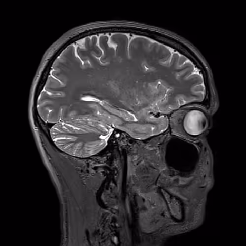 Brainybrains