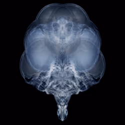Alien Embryo - 451 of 2000