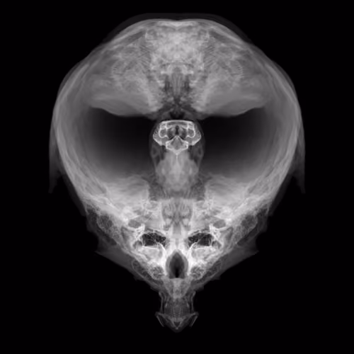 Alien Embryo - 365 of 2000