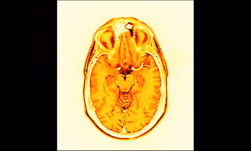 Item #64162533542198579898252916190583583845604629893829087458582976339528785068033 Media