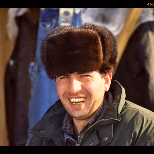 golden smile