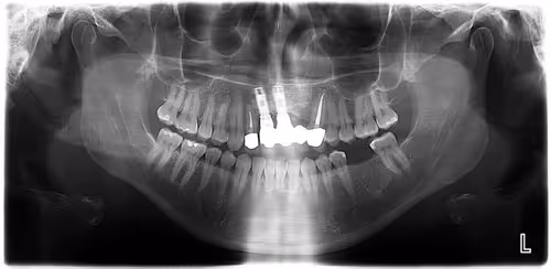 Item #84375876844769874995679511124378512056142188775641333661891558523137052114945 Media