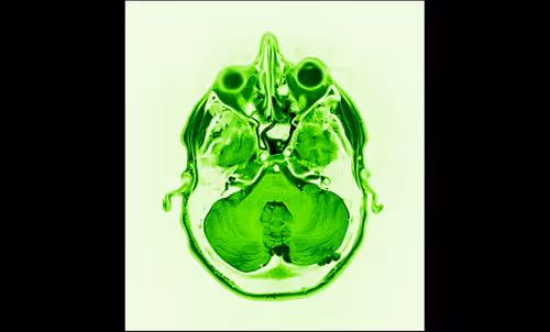 Item #64162533542198579898252916190583583845604629893829087458582975961296785113089 Media