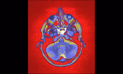 Item #64162533542198579898252916190583583845604629893829087458582975931609971163137 Media