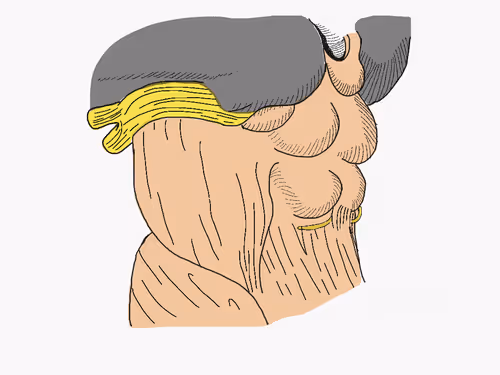 Neurology