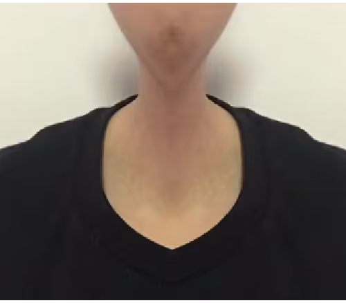 Untitled Collection #93397680