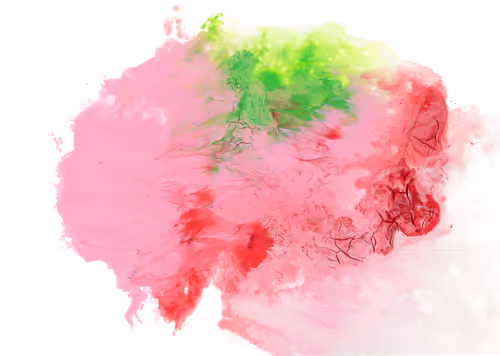 Item #66736690279118703969670916342624545511909248920861244220246673129978235715585 Media