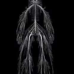 X-rays