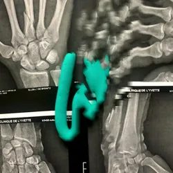 42502377884493822439484110895335049498054174976923948741203377837258949263361