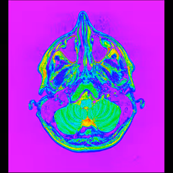 64162533542198579898252916190583583845604629893829087458582975757887133974529