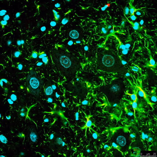 Item #56093845266365580198989074568914204894151473020386784908679452215816063287297 Media