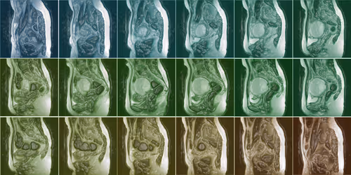 Item #33729904487083342964442328512687567246375750320202692497428806273580344016897 Media