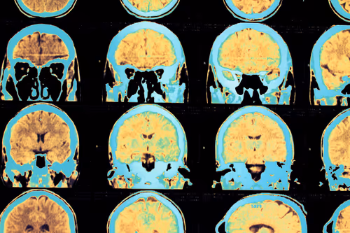 Item #12246497792079374647736198133812001247597722892673052682531412290038770171905 Media