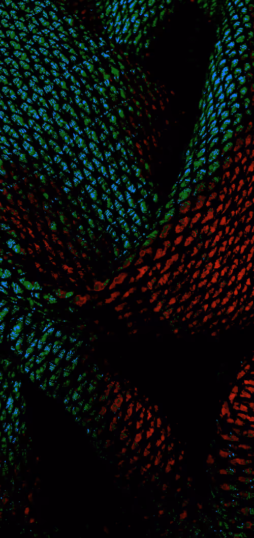 Item #101746795180037313257185168409734023878203362326426365319344639694475806900225 Media